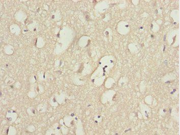 KPNA5 Antibody