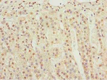 KPNA6 Antibody
