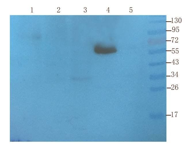 Krox-20 (EGR2) antibody