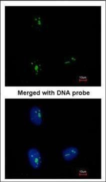 KRR1 Rabbit Polyclonal Antibody