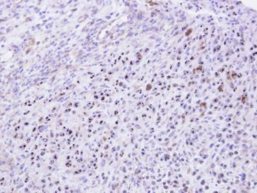 KRR1 Rabbit Polyclonal Antibody