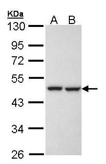 KRR1 Rabbit Polyclonal Antibody