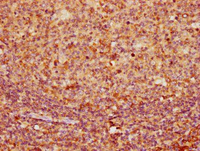 KRT16 Antibody