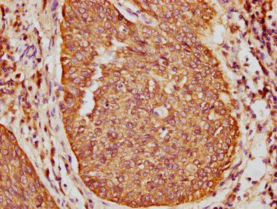 KRT16 Antibody