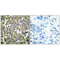 KRT16 Antibody