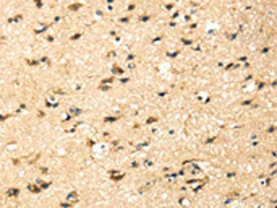 KRT17 Antibody