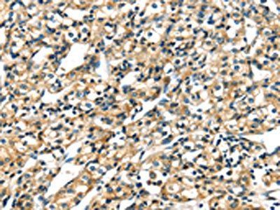KRT17 Antibody