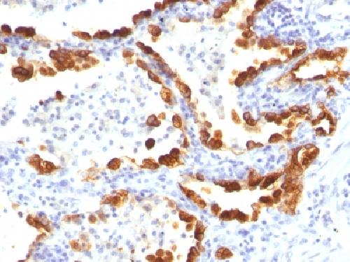 KRT18 Antibody