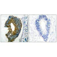 KRT18 Antibody