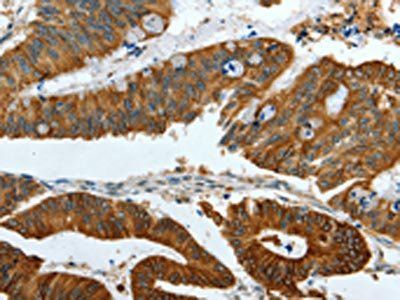 KRT19 Antibody