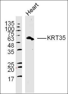 KRT35 Rabbit Polyclonal Antibody