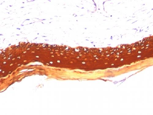 KRT77 Antibody