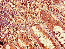 KRT81 Antibody