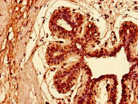 KRT81 Antibody