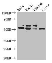 KRT81 Antibody