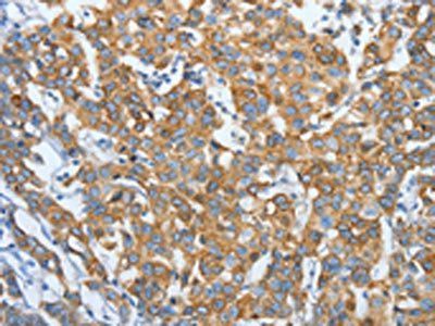 KRT81 Antibody