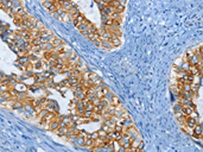 KRT81 Antibody
