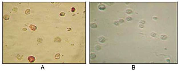 KSHV ORF45 Antibody