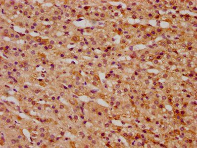 KTI12 Antibody
