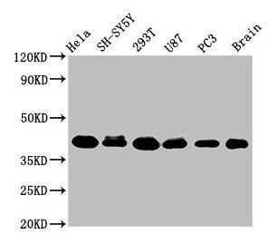 KTI12 Antibody