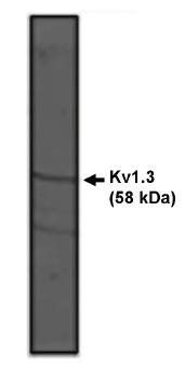 Rabbit Rat Kv1.3 Potassium Channel Antibody