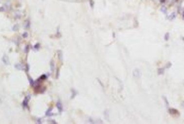 HDC Rabbit Polyclonal Antibody