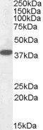 Laforin (isoform a) Antibody
