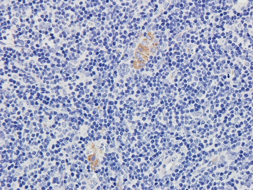 LAG3 Rabbit Polyclonal Antibody