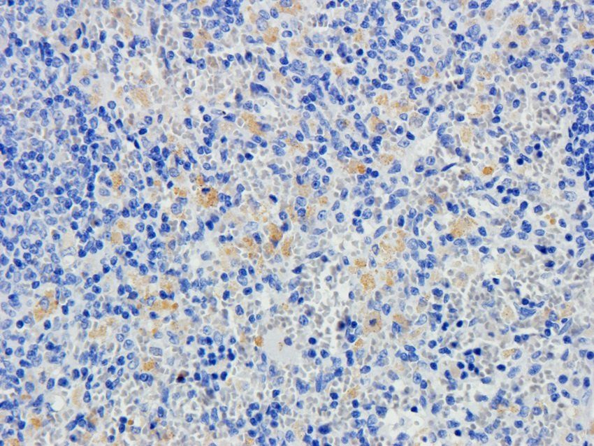 LAG3 Rabbit Polyclonal Antibody