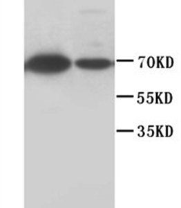 Lamin B1/LMNB1 Rabbit Polyclonal Antibody