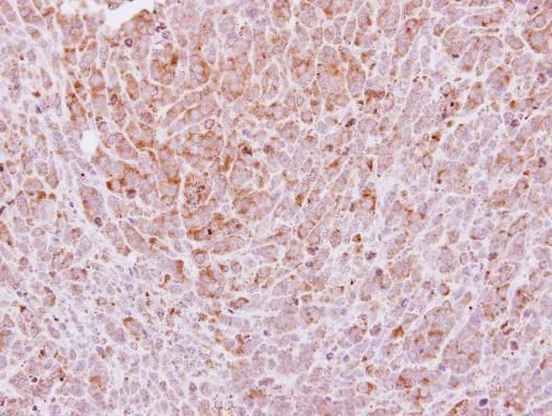 integrin subunit alpha 2b Antibody