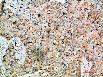 LAMP3 Antibody