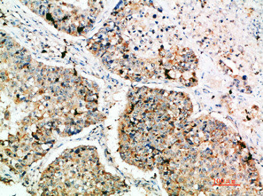 LAMP3 Antibody
