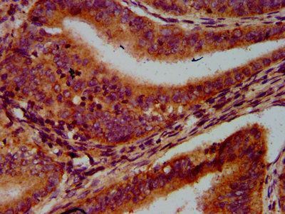 LAMTOR1 Antibody