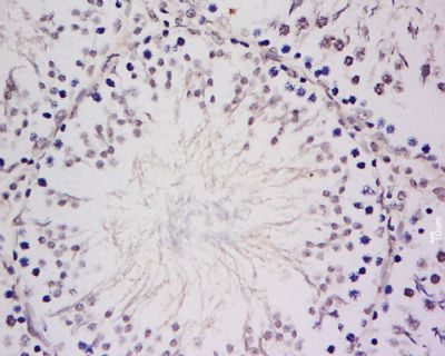 LANCL2 Rabbit Polyclonal Antibody