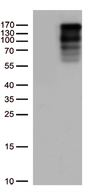 LARP1 Antibody