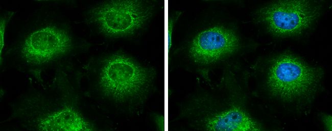 LARS2 Rabbit Polyclonal Antibody