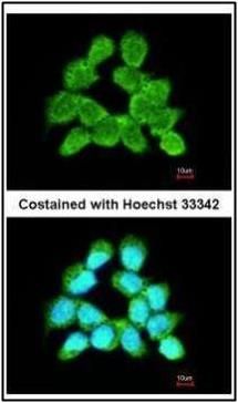 LARS2 Rabbit Polyclonal Antibody