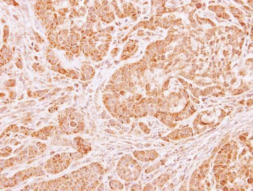 LARS2 Rabbit Polyclonal Antibody