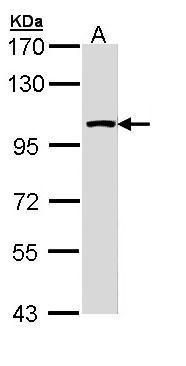 LARS2 Rabbit Polyclonal Antibody