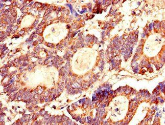 LASP1 Antibody