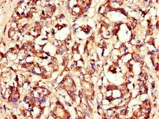 LASP1 Antibody