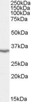LASP1 (N Terminus) Antibody