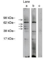 Rabbit Human Lass1 (Crossreacts with GDF1) Antibody