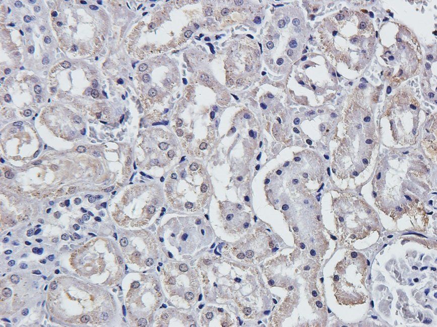 LAT4 Rabbit Polyclonal Antibody