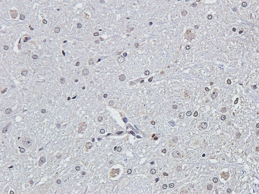 LAT4 Rabbit Polyclonal Antibody