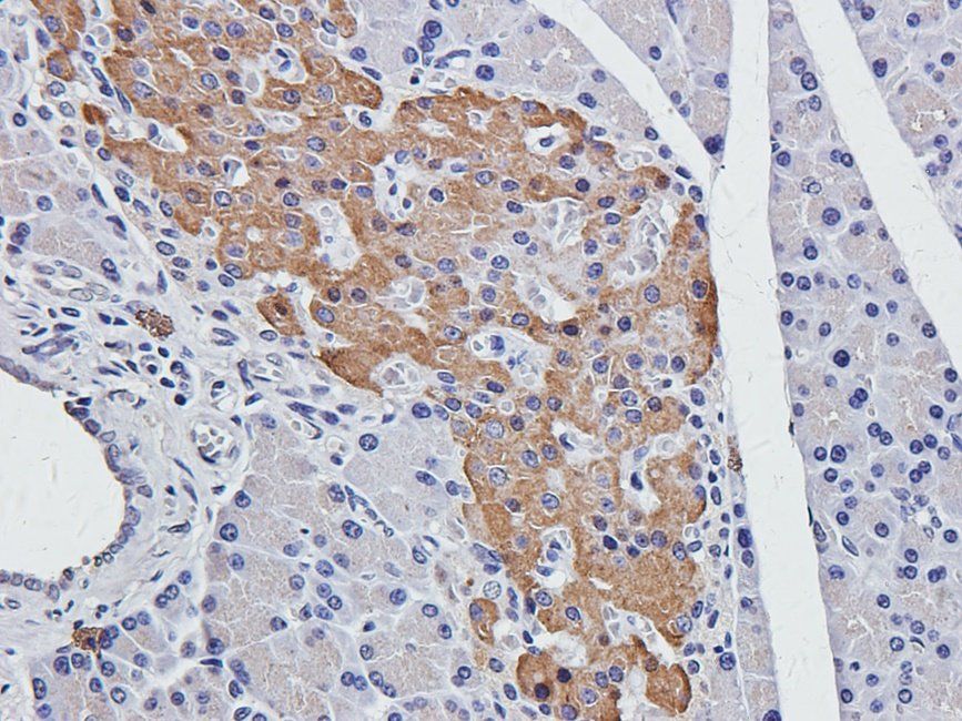 LAT4 Rabbit Polyclonal Antibody
