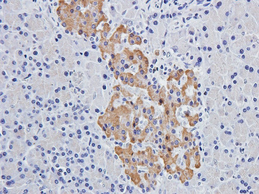 LAT4 Rabbit Polyclonal Antibody