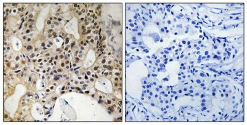 LATS1/2 (Ab-1079/1041) Antibody