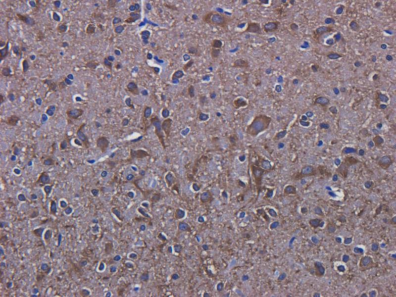 LC3 antibody